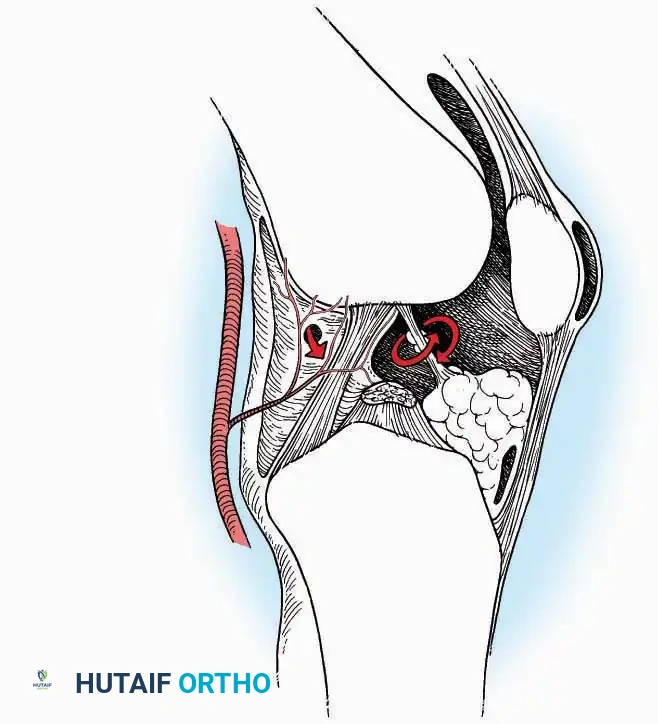 Hutaifortho's Orthopaedic Diagram