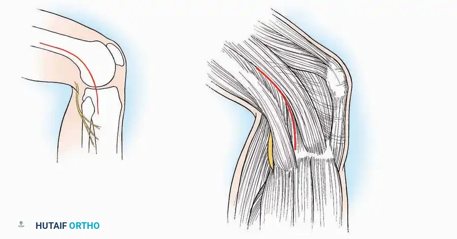 Hutaifortho's Orthopaedic Diagram