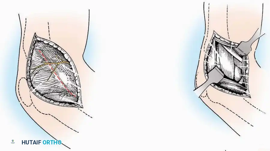 Hutaifortho's Orthopaedic Diagram