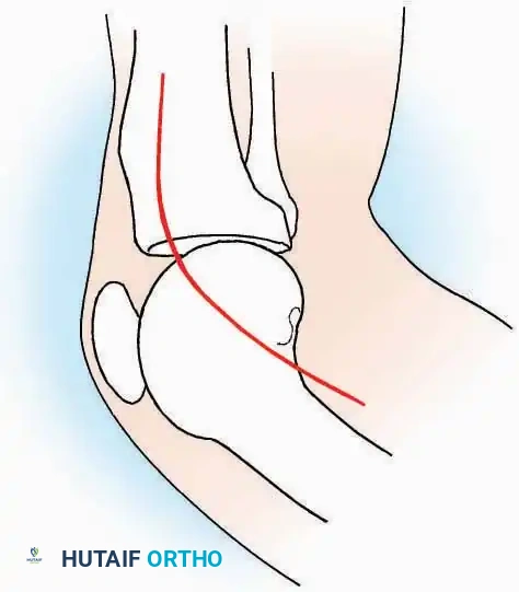 Hutaifortho's Orthopaedic Diagram