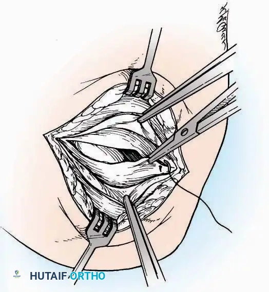 Hutaifortho's Orthopaedic Diagram