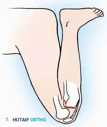 Hutaifortho's Orthopaedic Diagram