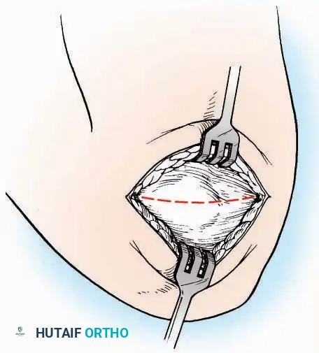 Hutaifortho's Orthopaedic Diagram