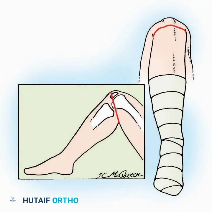 Hutaifortho's Orthopaedic Diagram