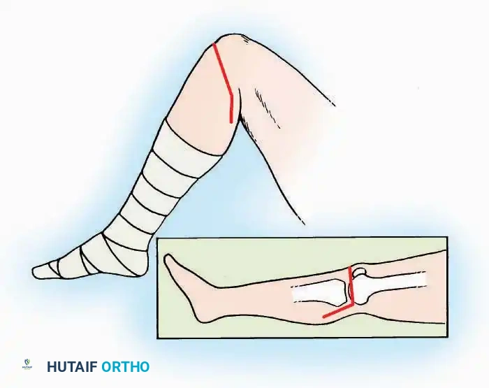 Hutaifortho's Orthopaedic Diagram