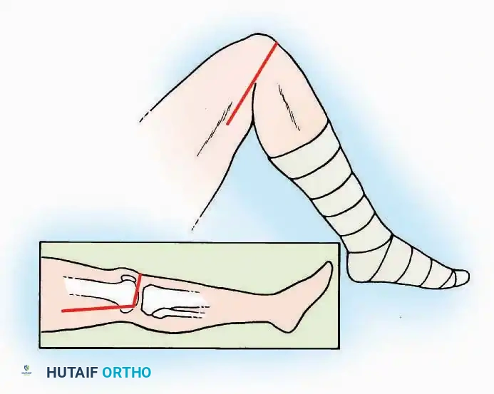 Hutaifortho's Orthopaedic Diagram