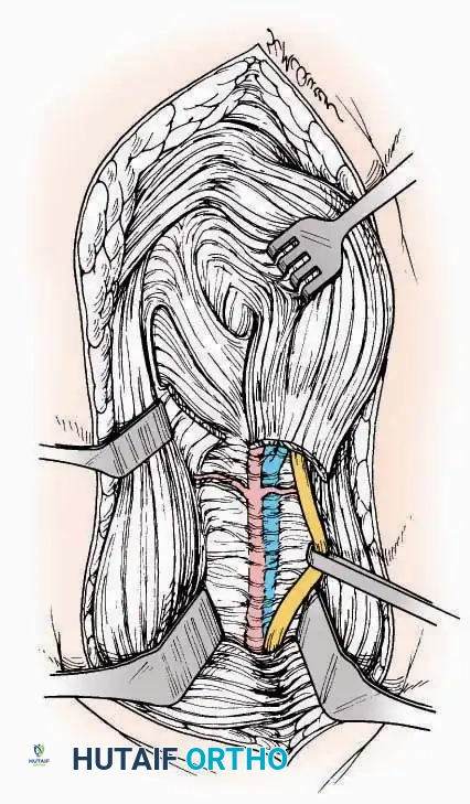 Hutaifortho's Orthopaedic Diagram