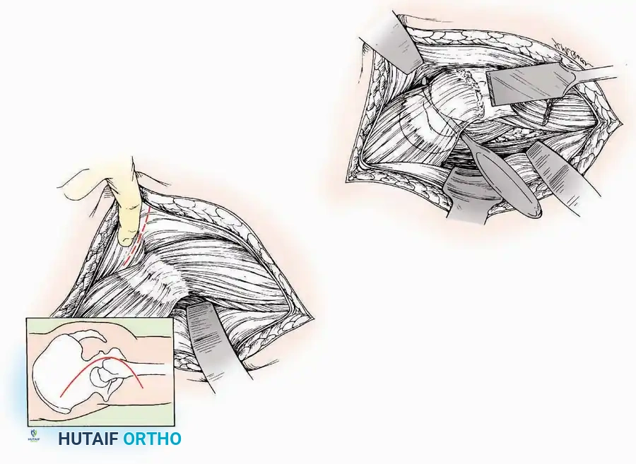 Hutaifortho's Orthopaedic Diagram