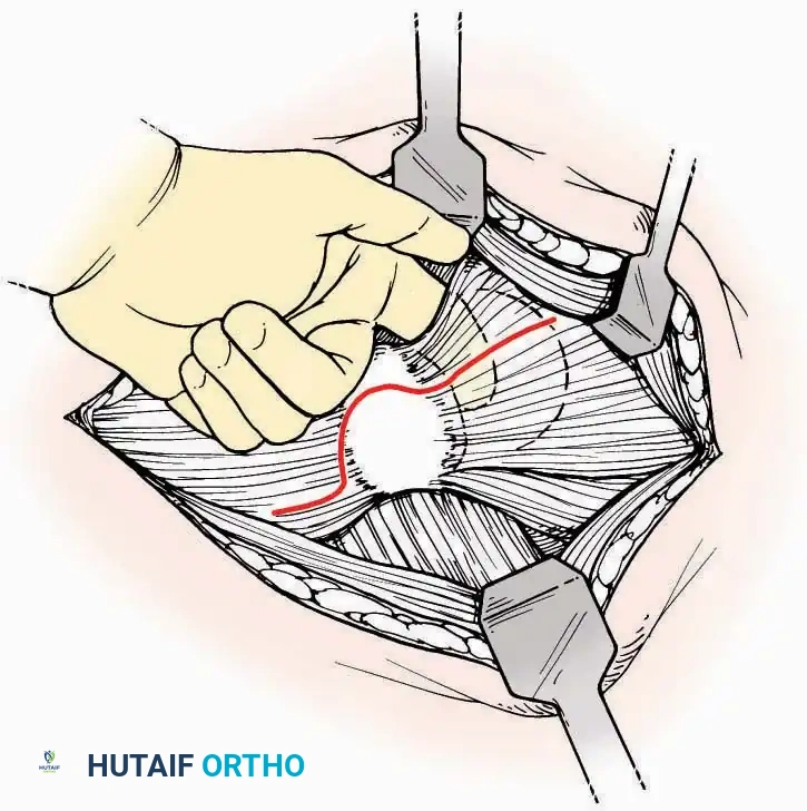 Hutaifortho's Orthopaedic Diagram