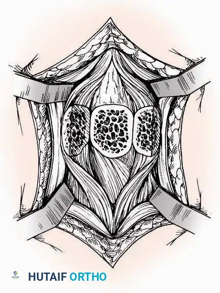 Hutaifortho's Orthopaedic Diagram