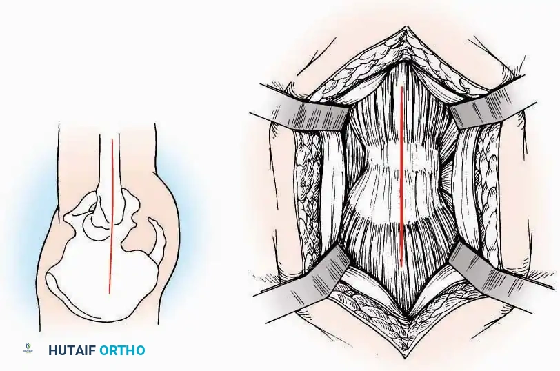 Hutaifortho's Orthopaedic Diagram
