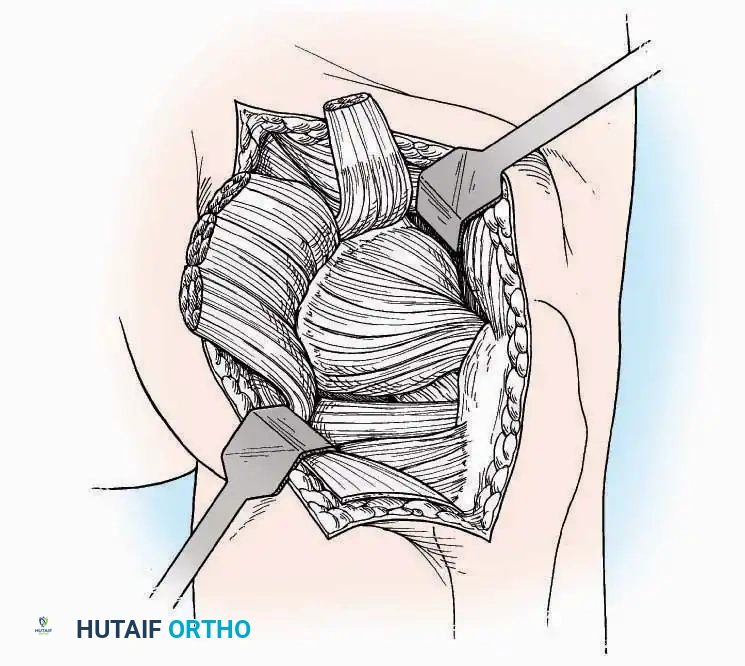 Hutaifortho's Orthopaedic Diagram