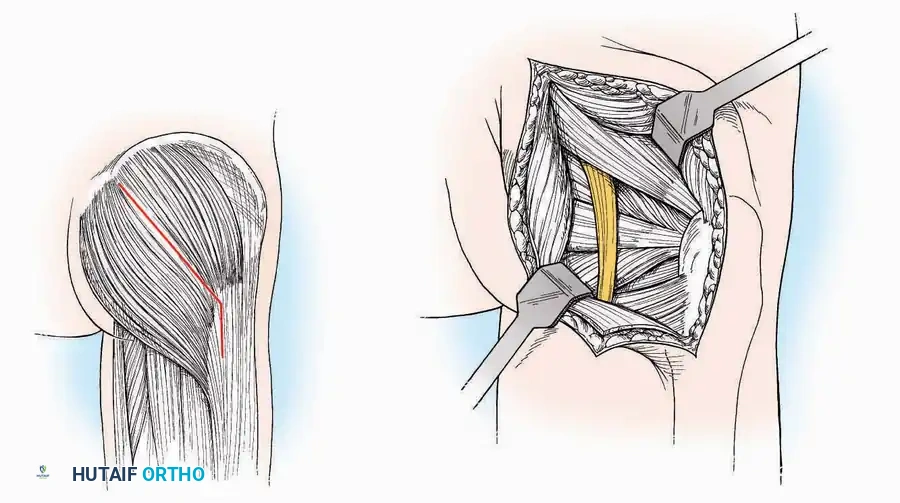 Hutaifortho's Orthopaedic Diagram