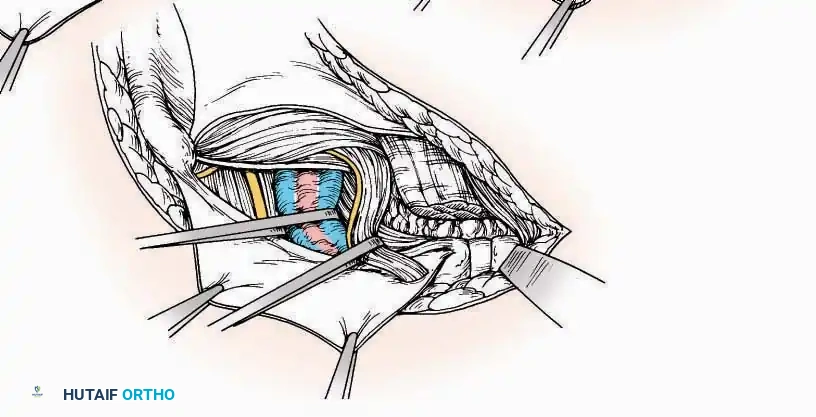 Hutaifortho's Orthopaedic Diagram