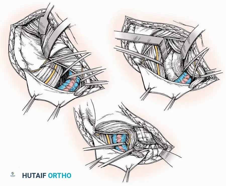Hutaifortho's Orthopaedic Diagram