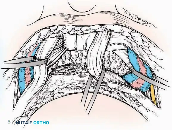 Hutaifortho's Orthopaedic Diagram