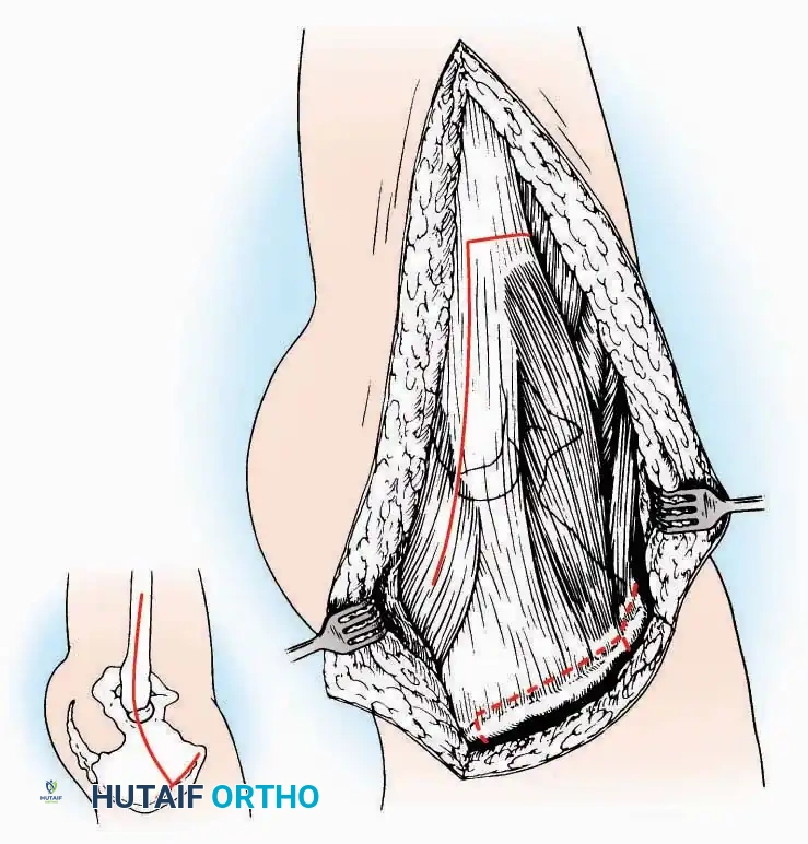 Hutaifortho's Orthopaedic Diagram