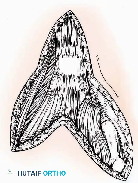 Hutaifortho's Orthopaedic Diagram