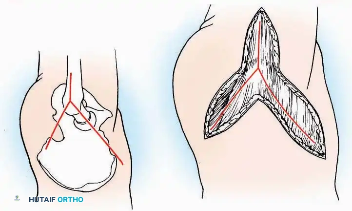 Hutaifortho's Orthopaedic Diagram