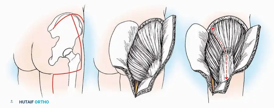 Hutaifortho's Orthopaedic Diagram