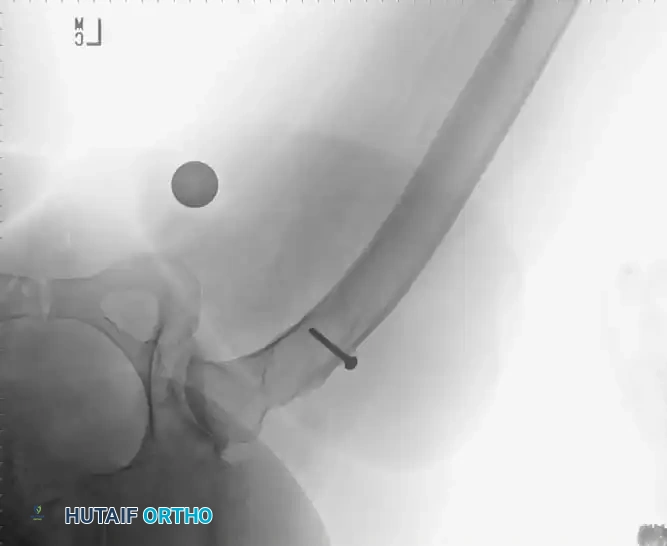 Hutaifortho's Orthopaedic Diagram