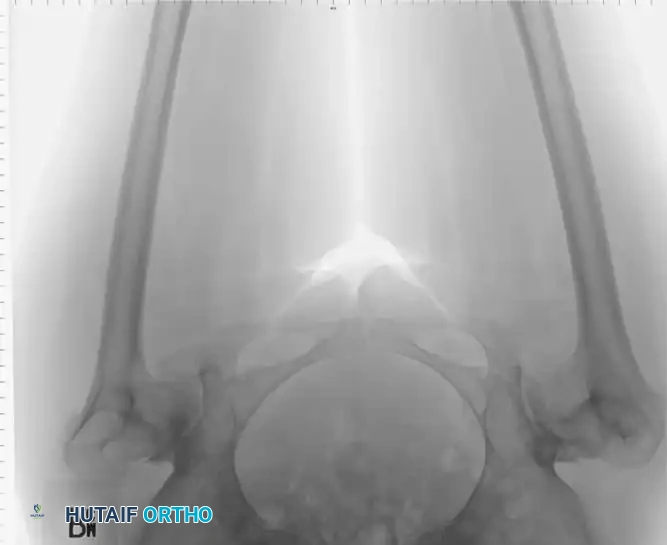 Hutaifortho's Orthopaedic Diagram