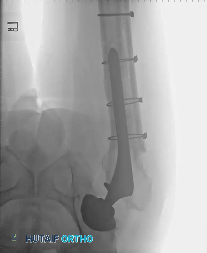 Hutaifortho's Orthopaedic Diagram