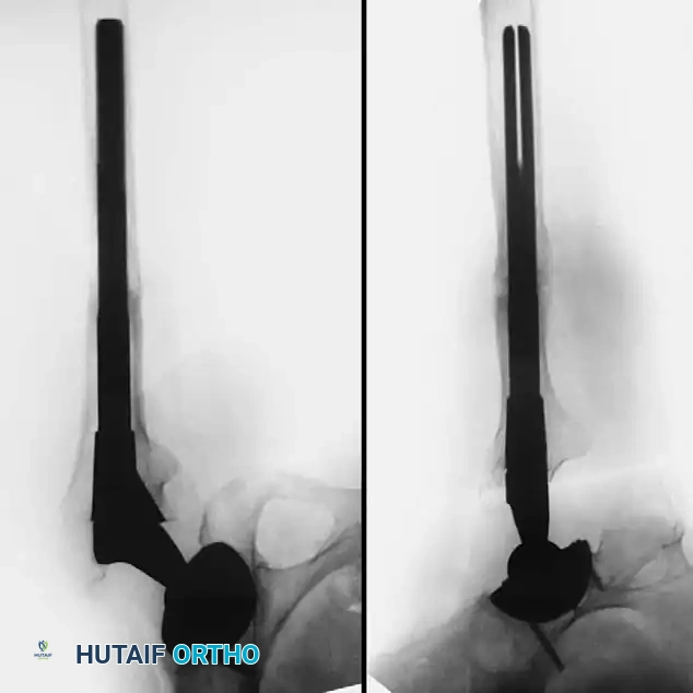 Hutaifortho's Orthopaedic Diagram