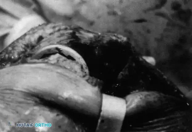 Hutaifortho's Orthopaedic Diagram