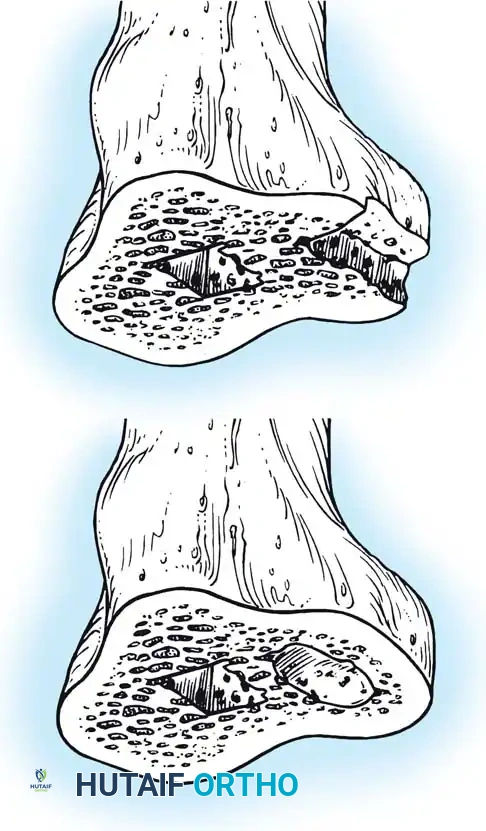 Hutaifortho's Orthopaedic Diagram