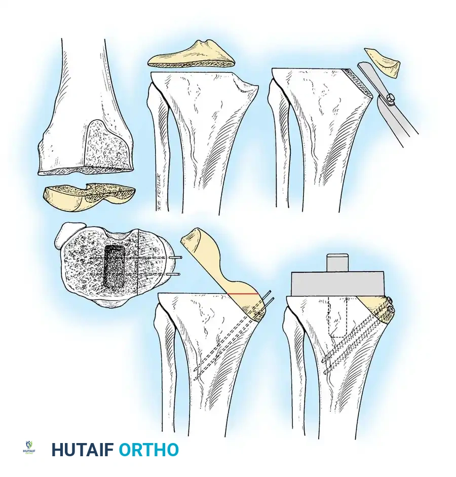 Hutaifortho's Orthopaedic Diagram