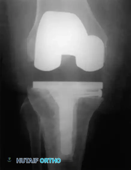 Hutaifortho's Orthopaedic Diagram