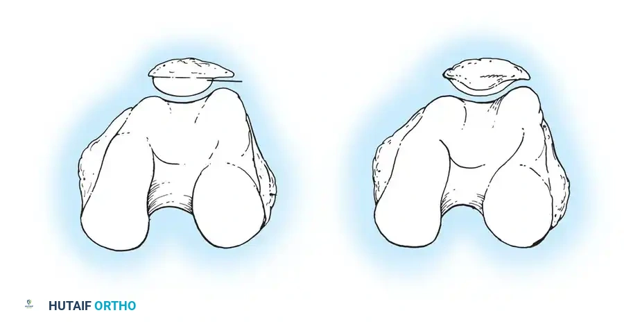 Hutaifortho's Orthopaedic Diagram