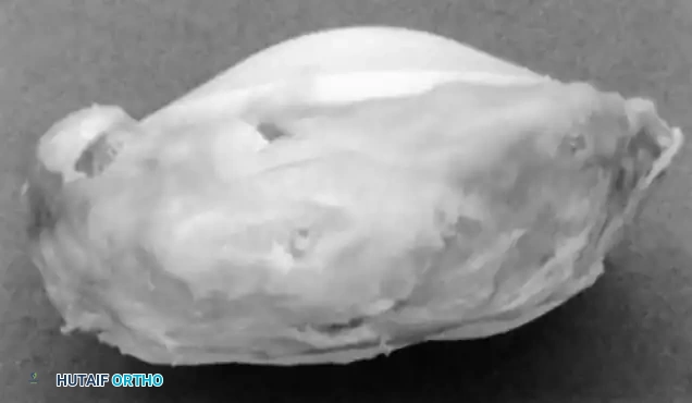 Hutaifortho's Orthopaedic Diagram