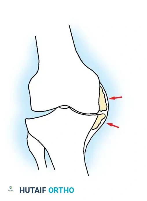 Hutaifortho's Orthopaedic Diagram