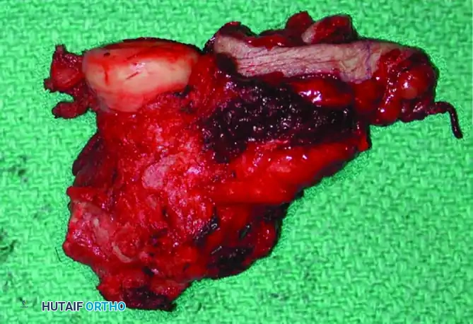 Hutaifortho's Orthopaedic Diagram