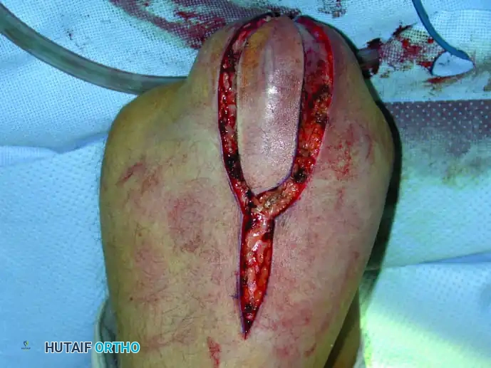 Hutaifortho's Orthopaedic Diagram