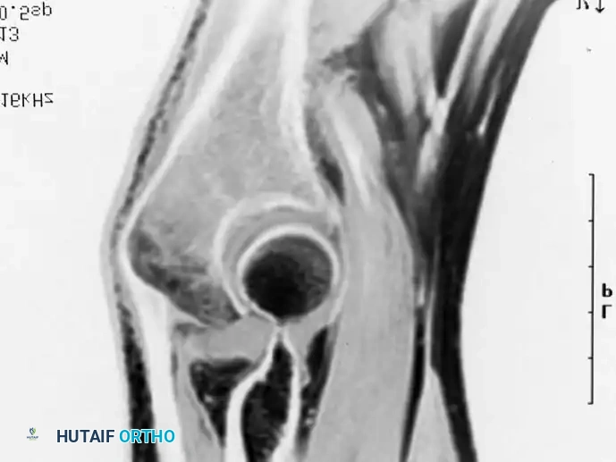 Hutaifortho's Orthopaedic Diagram