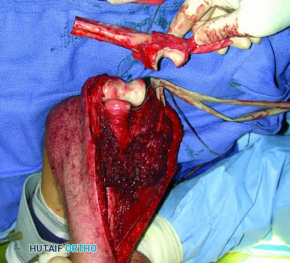 Hutaifortho's Orthopaedic Diagram