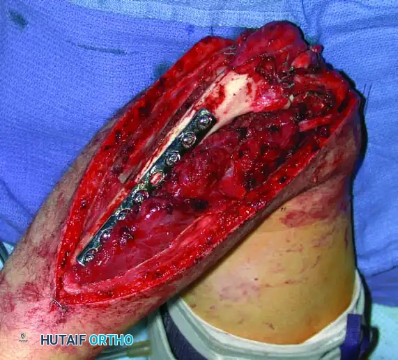 Hutaifortho's Orthopaedic Diagram