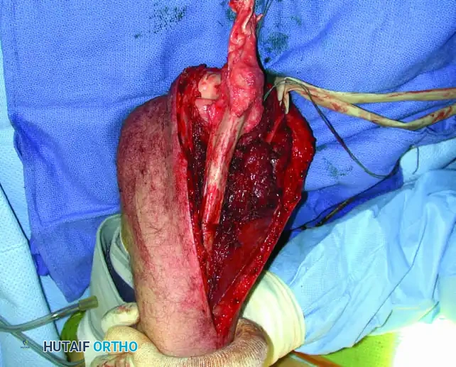 Hutaifortho's Orthopaedic Diagram