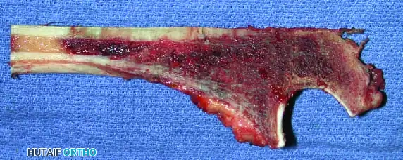 Hutaifortho's Orthopaedic Diagram
