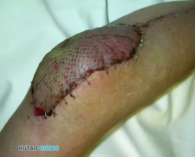 Hutaifortho's Orthopaedic Diagram