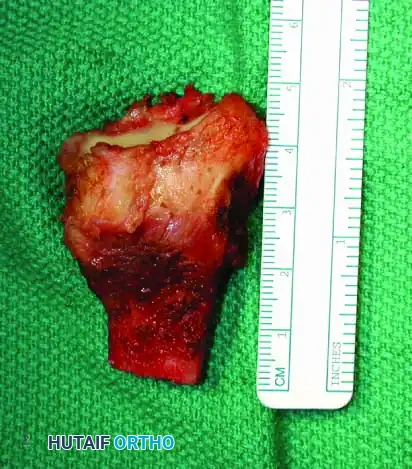 Hutaifortho's Orthopaedic Diagram