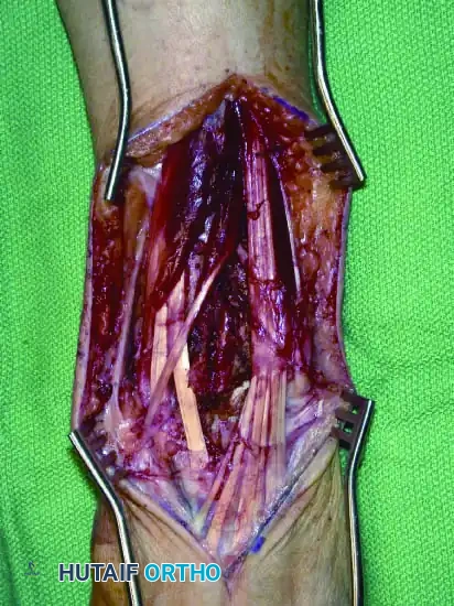 Hutaifortho's Orthopaedic Diagram