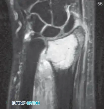 Hutaifortho's Orthopaedic Diagram