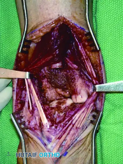 Hutaifortho's Orthopaedic Diagram