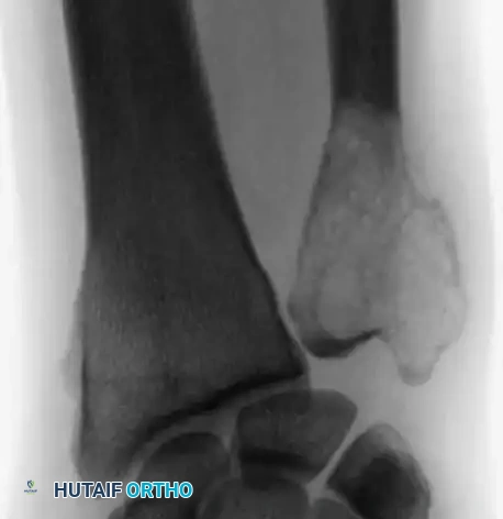 Hutaifortho's Orthopaedic Diagram
