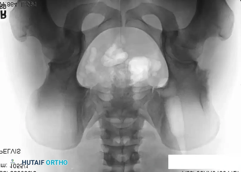 Hutaifortho's Orthopaedic Diagram