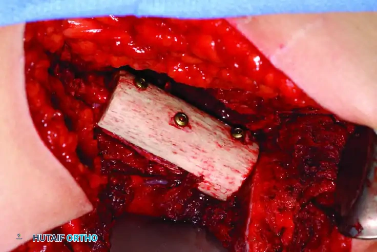 Hutaifortho's Orthopaedic Diagram
